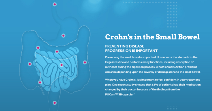 Small Bowel Crohns
