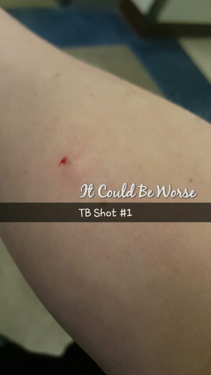 Two Step TB Test - WK 1 - It Could Be Worse