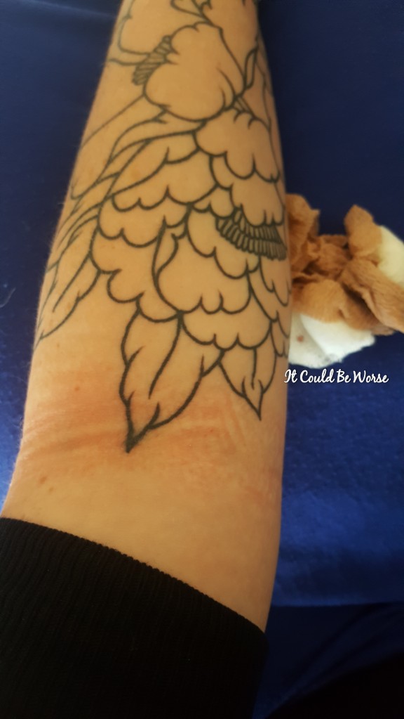 Entyvio Infusion #4 - It Could Be Worse Blog - Mary Horsley