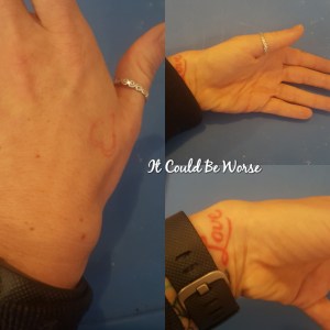 Seeing All of the Doctors - Another Month in My Crohn's Journey