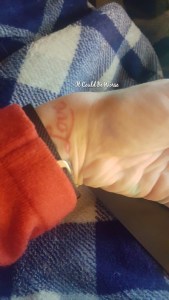 Lumpy, the Ganglion Cyst, A Trilogy - It Could Be Worse - Mary Horsley
