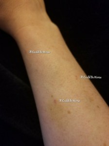 Stelara Infusion & Ganglionectomy Pain - It Could Be Worse - Mary Horsley