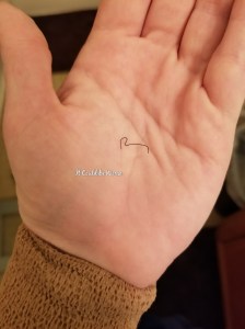 February - It Could Be Worse Blog- Mary Horsley - Ganglionectomy stitches