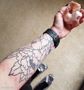 Stelara Self-Injection #1 | It Could Be Worse Blog