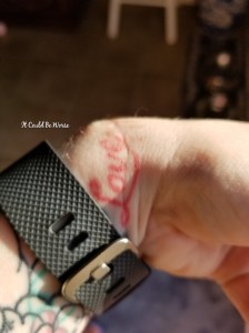 Lumpy, the Ganglion Cyst, A Trilogy - It Could Be Worse - Mary Horsley