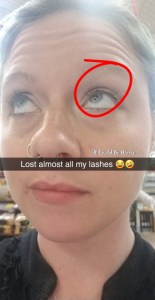Stelara Self-Injection #2 & Rib Pain - It Could Be Worse Blog - Mary Horsley