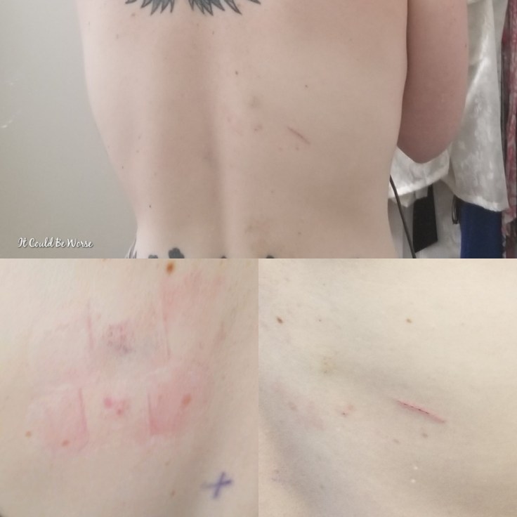 TWO MONTHS TIME | IT COULD BE WORSE BLOG

#crohnsdisease #itcouldbeworse

https://itcouldbeworseblog.com/2018/08/27/two-months-time-it-could-be-worse-blog/ - Mary Darlene