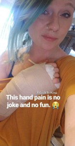 My Ganglion Cyst - The Tetralogy | IT COULD BE WORSE BLOG