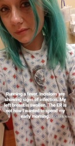 Rib Plating Surgery and Thoracic Appointments | IT COULD BE WORSE BLOG