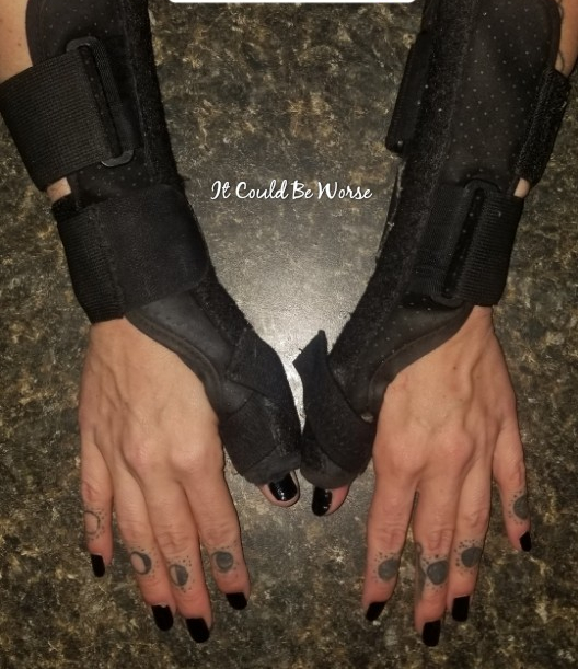 Any Way You Slice It - Thoracic & Hand Surgery, Again