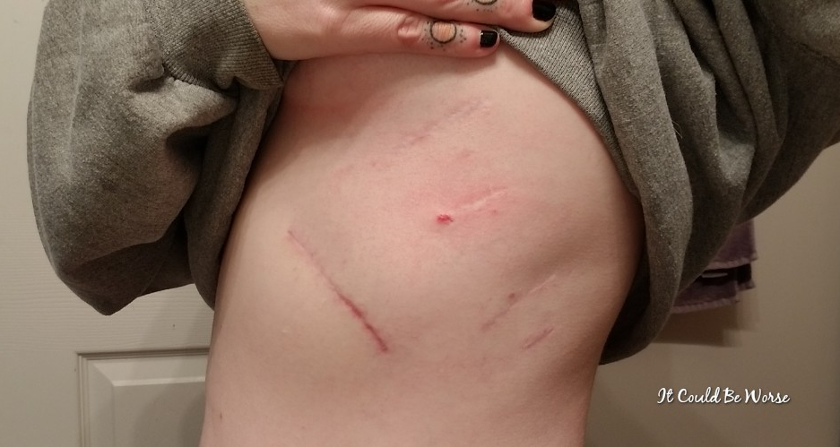 Any Way You Slice It - Thoracic & Hand Surgery, Again
