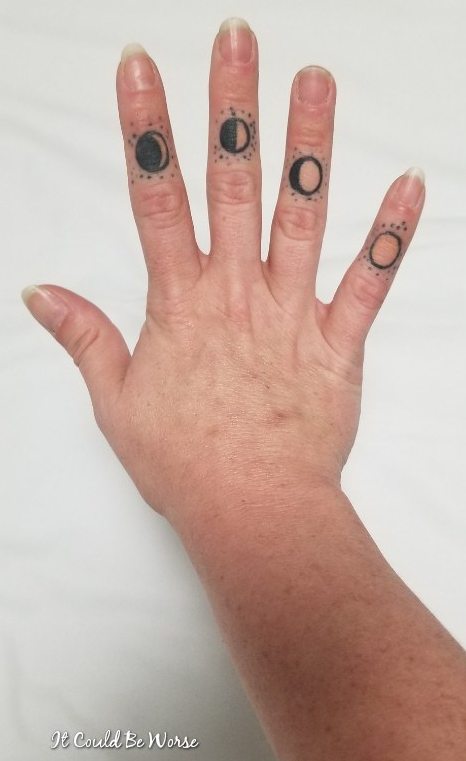 Seven Scars & My 10th Procedure
