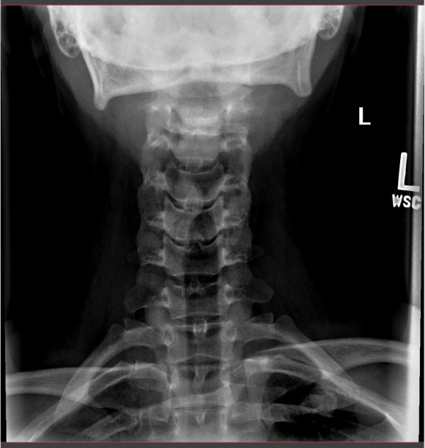 Pain in the Neck - It Could Be Worse