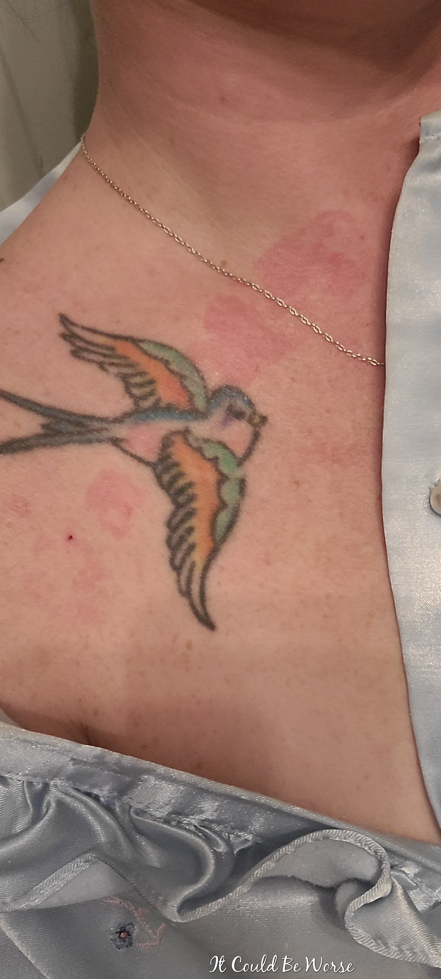 Pain in the Neck - It Could Be Worse Blog
